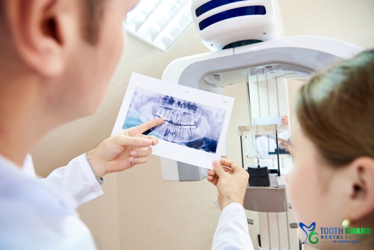 طبعة الاسنان الرقمية (الديجيتال سكانر)